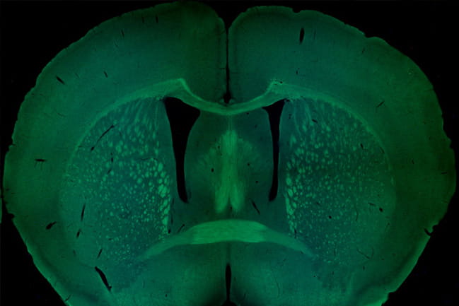 Coronal section of a mouse brain, with several major axonal tracts stained in green.