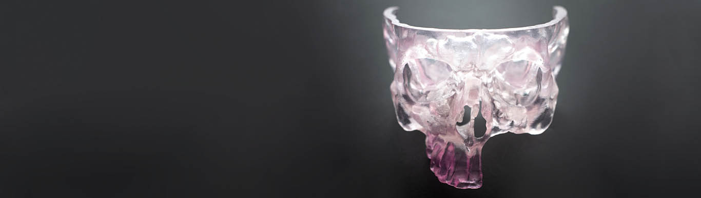 Image of 3D printed skull.