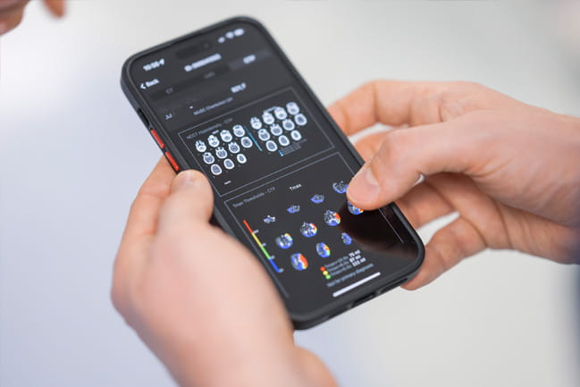 Smartphone with app showing MRI scans