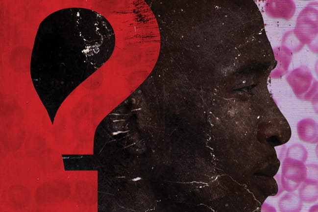 Sickle Cell Illustration 